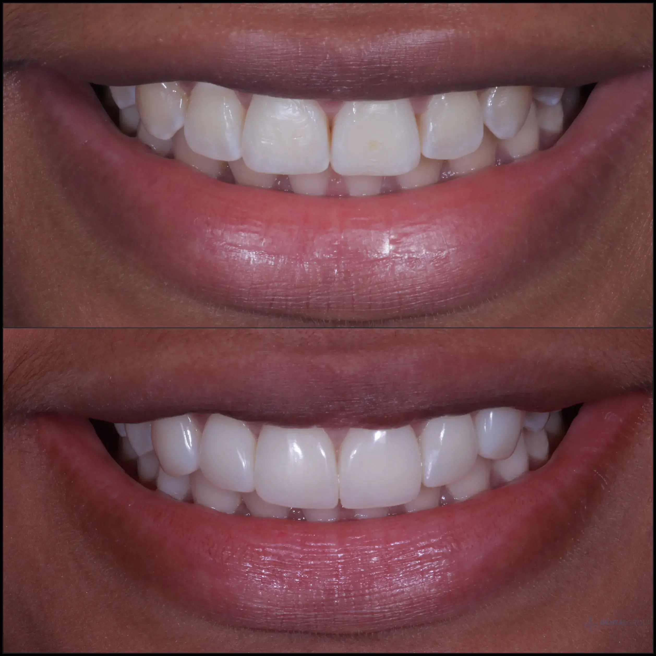 1A31C3FB-FEA1-4B1B-9608-A4EB56243852